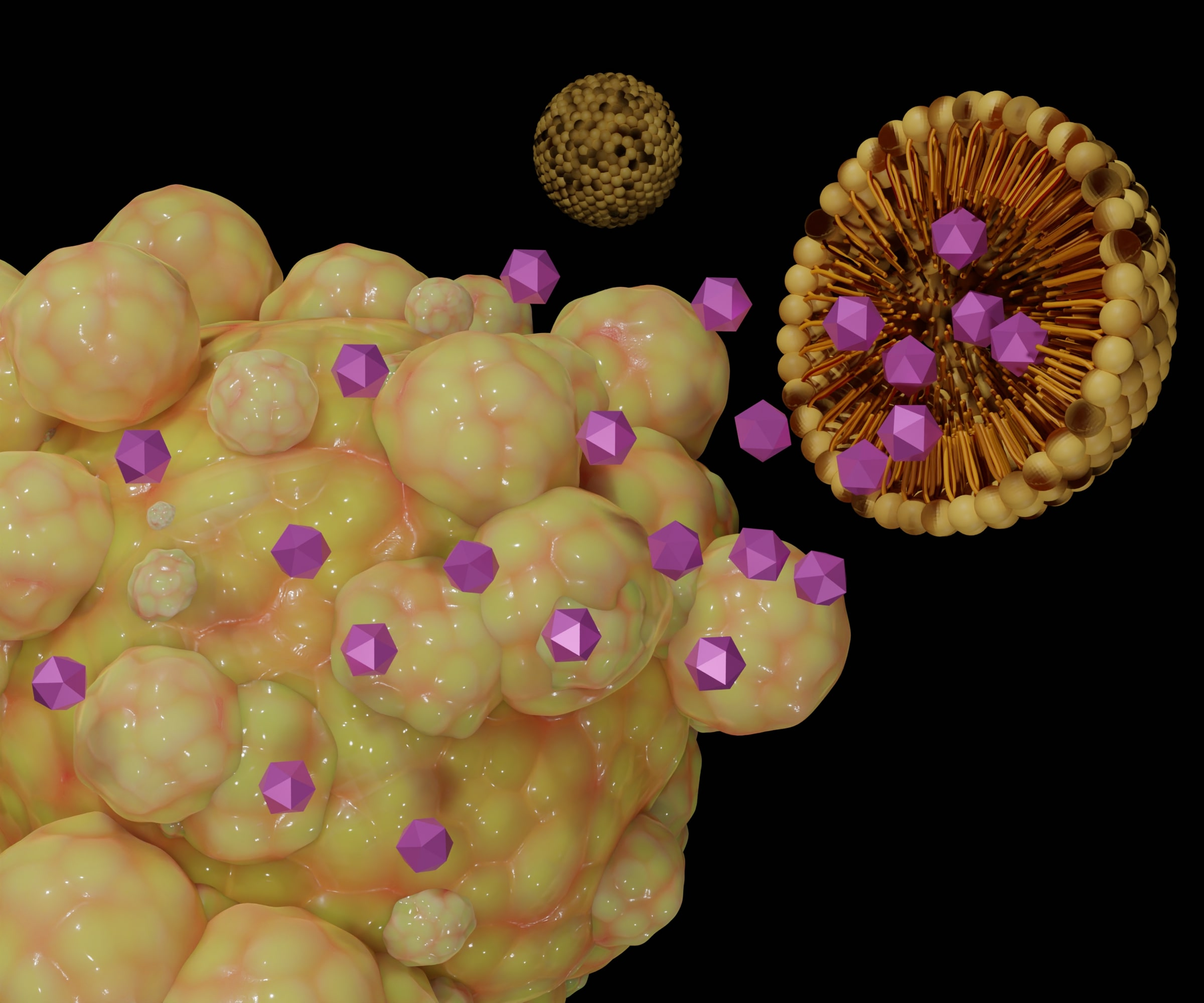 Lipoic acid-boronophenylalanine-derived multifunctional vesicles for cancer chemoradiotherapy